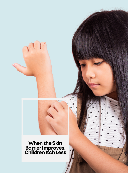 When the Skin Barrier Improves, Children Itch Less